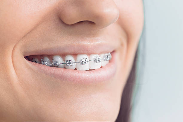 Best Traditional Braces  in Chelsea, OK